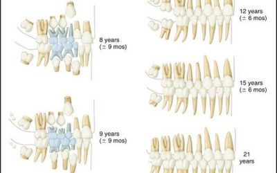 Children’s Dentistry Caringbah – Dental Development Milestones