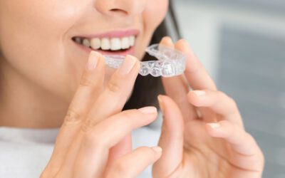 Invisalign case study